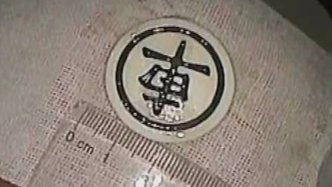 象棋大輸突翻臉！陸男張口「吞車」慘卡食道10小時
