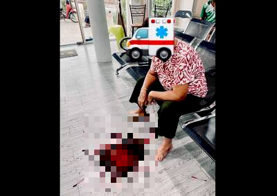 通博娛樂城-國際資訊-太驚悚😨！泰國女猛吐「1公升鮮血」，竟是止痛藥當飯吃惹的禍！