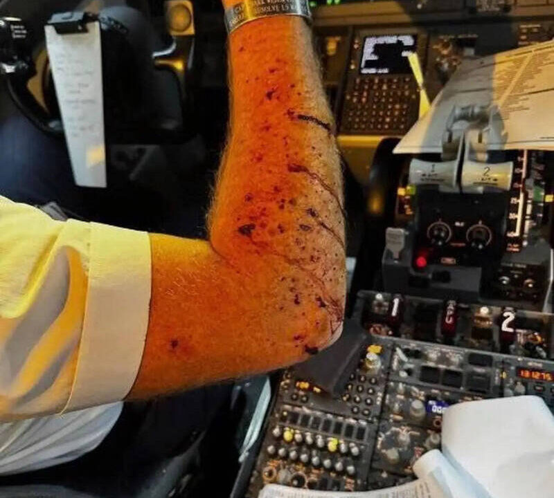 通博娛樂城-國際資訊-高空喋血！聯合航空駕駛艙玻璃「恐怖撞裂」，機師當場濺血，急降驚魂內幕曝光！