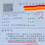 通博娛樂城-國際新聞-WTF？！ 😱 中國男病患CT報告驚見「子宮」！醫院的離奇解釋讓人更傻眼！