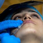 在砲火中微整形?烏克蘭醫美生意竟「逆勢爆炸」,背後原因揭開戰爭下的心酸真相!